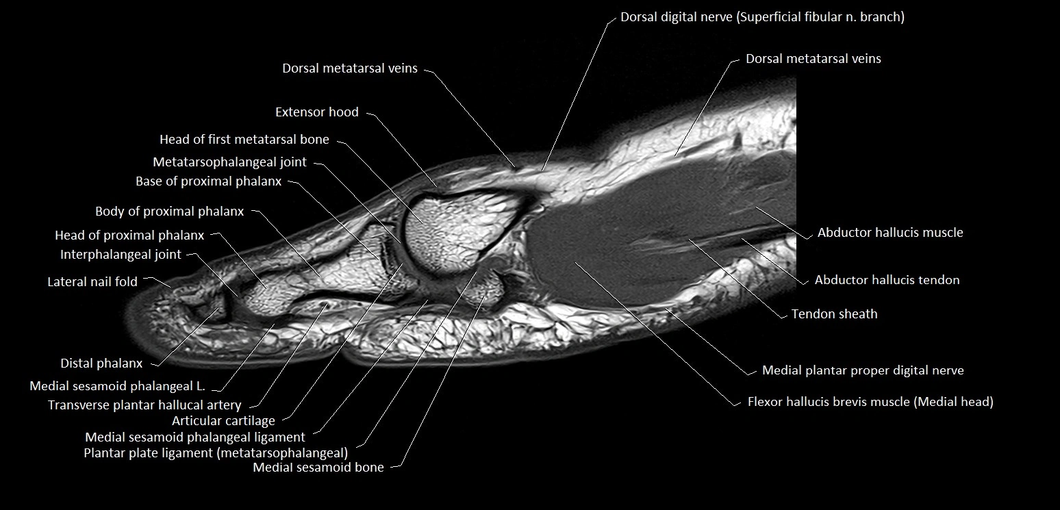 Hallux or big toe sagittal anatomy 3T MRI image 8.webp